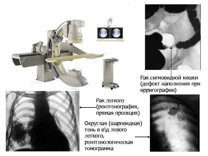 Рентгенография с прямым увеличением изображения применяется тест