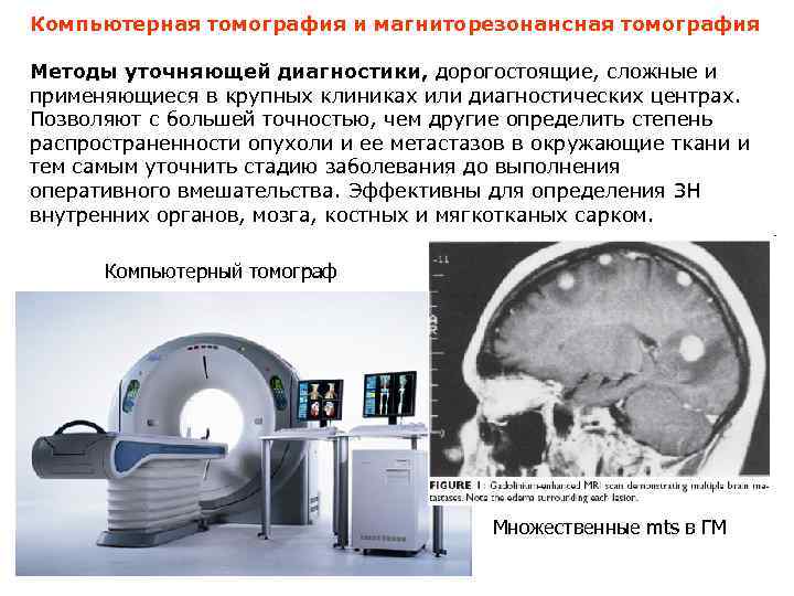 Ли кт. Метод компьютерной томографии. Компьютерная томография суть. Анализ кт. Компьютерная томография сущность метода.