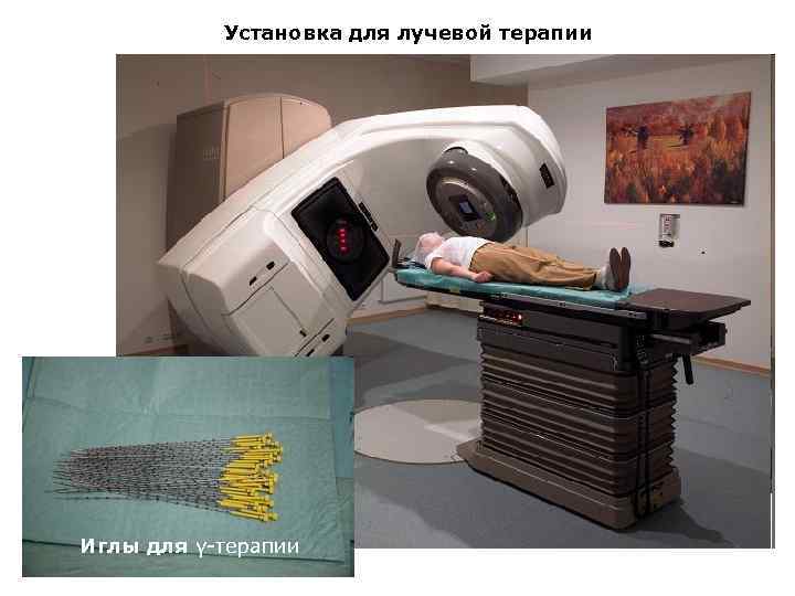 Установка для лучевой терапии Иглы для γ-терапии 