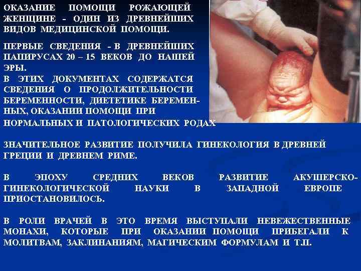 ОКАЗАНИЕ ПОМОЩИ РОЖАЮЩЕЙ ЖЕНЩИНЕ ОДИН ИЗ ДРЕВНЕЙШИХ ВИДОВ МЕДИЦИНСКОЙ ПОМОЩИ. ПЕРВЫЕ СВЕДЕНИЯ В ДРЕВНЕЙШИХ