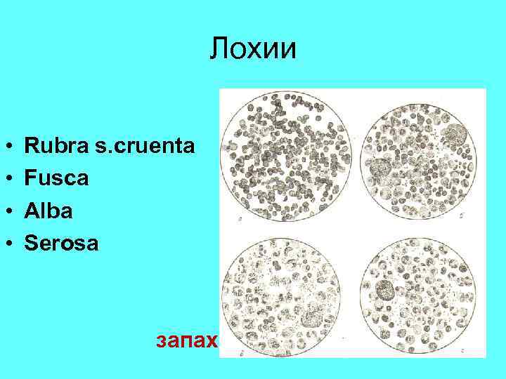 Лохии • • Rubra s. cruenta Fusca Alba Serosa запах 