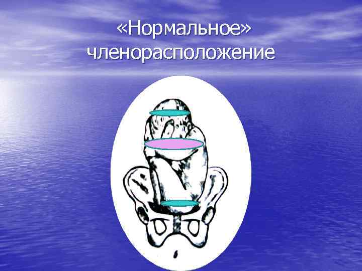  «Нормальное» членорасположение 