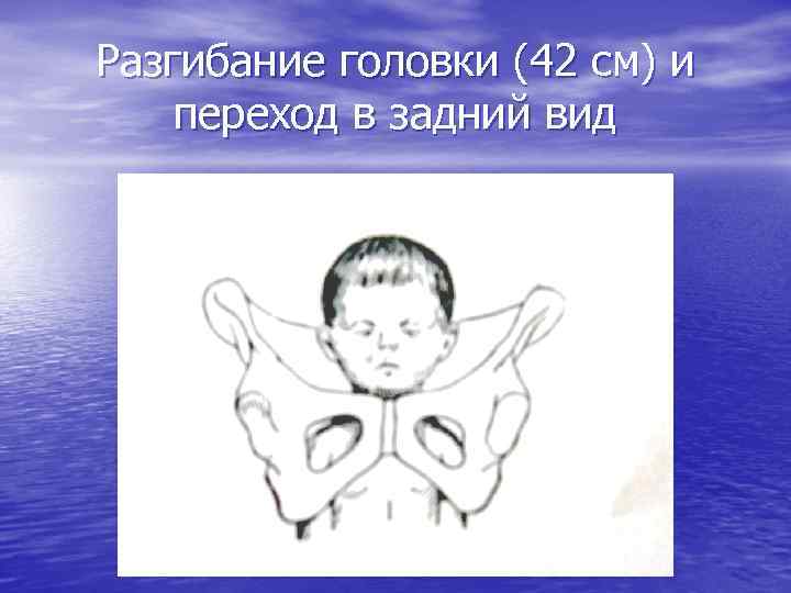 Разгибание головки (42 см) и переход в задний вид 