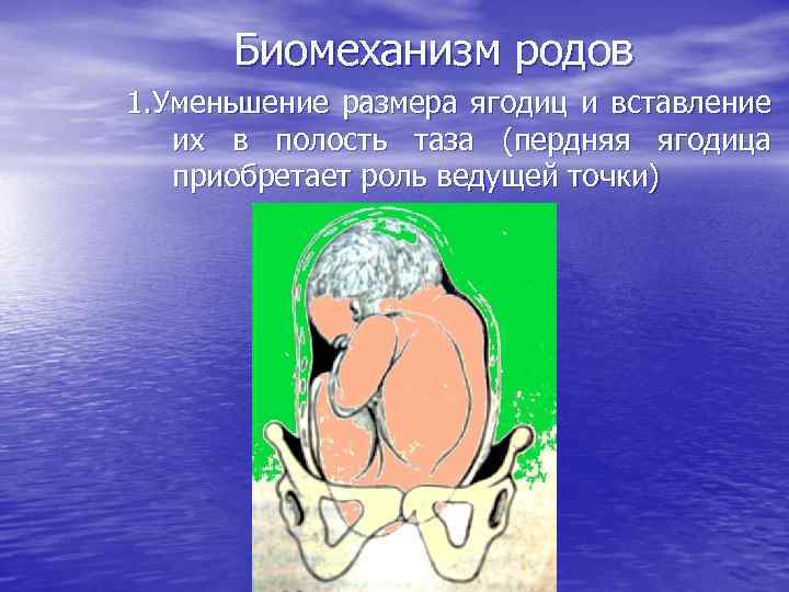 Биомеханизм родов 1. Уменьшение размера ягодиц и вставление их в полость таза (пердняя ягодица
