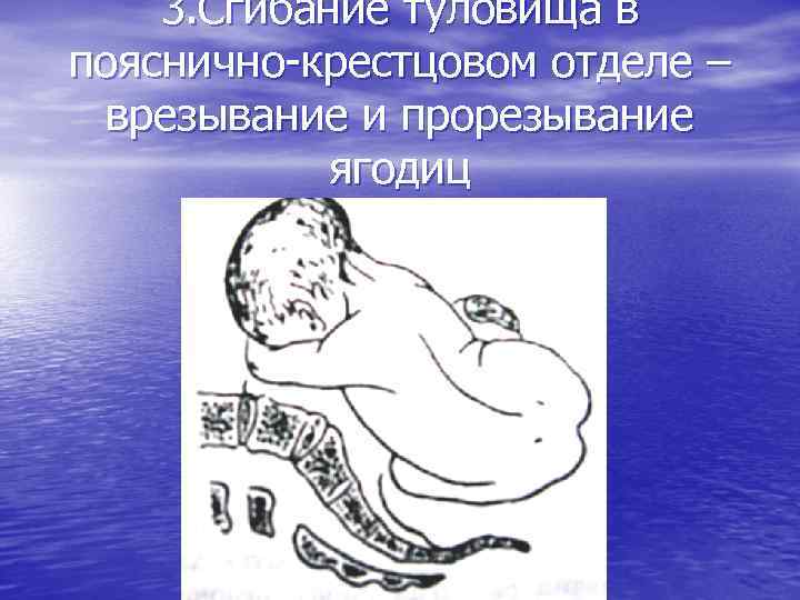 3. Сгибание туловища в пояснично-крестцовом отделе – врезывание и прорезывание ягодиц 