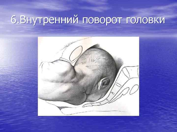 6. Внутренний поворот головки 