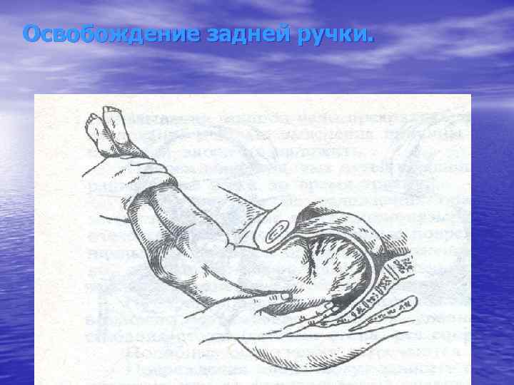 Освобождение задней ручки. 