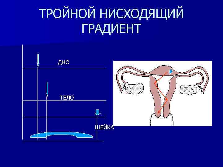 Раскрой матку. Матка тройной градиент сокращения. Тройной нисходящий градиент Акушерство. Принцип тройного нисходящего градиента. Пейсмейкер располагается в матке.