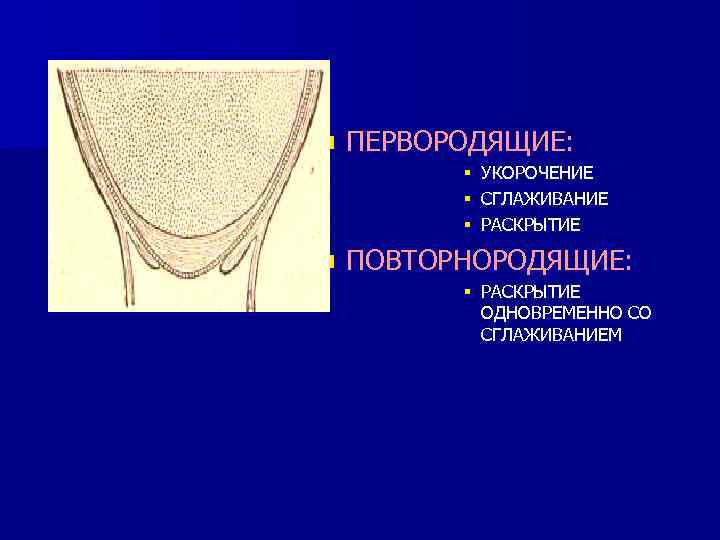 n ПЕРВОРОДЯЩИЕ: § § § n УКОРОЧЕНИЕ СГЛАЖИВАНИЕ РАСКРЫТИЕ ПОВТОРНОРОДЯЩИЕ: § РАСКРЫТИЕ ОДНОВРЕМЕННО СО