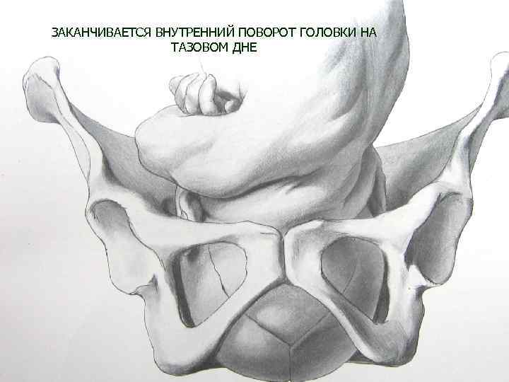 ЗАКАНЧИВАЕТСЯ ВНУТРЕННИЙ ПОВОРОТ ГОЛОВКИ НА ТАЗОВОМ ДНЕ 