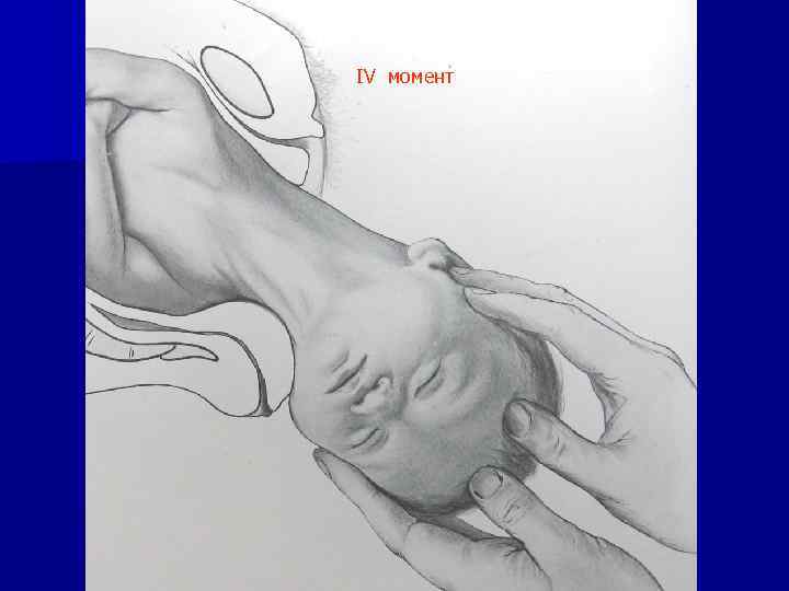 IV момент 