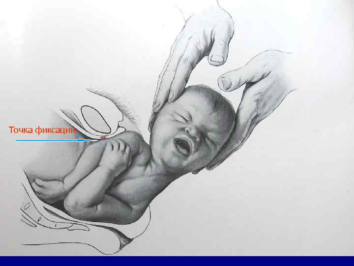 Точка фиксации 