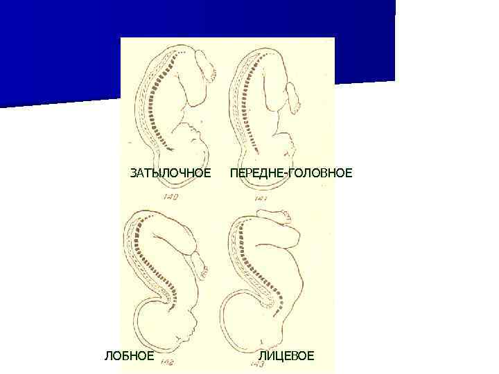ЗАТЫЛОЧНОЕ ЛОБНОЕ ПЕРЕДНЕ-ГОЛОВНОЕ ЛИЦЕВОЕ 