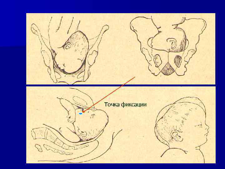 Точка фиксации 