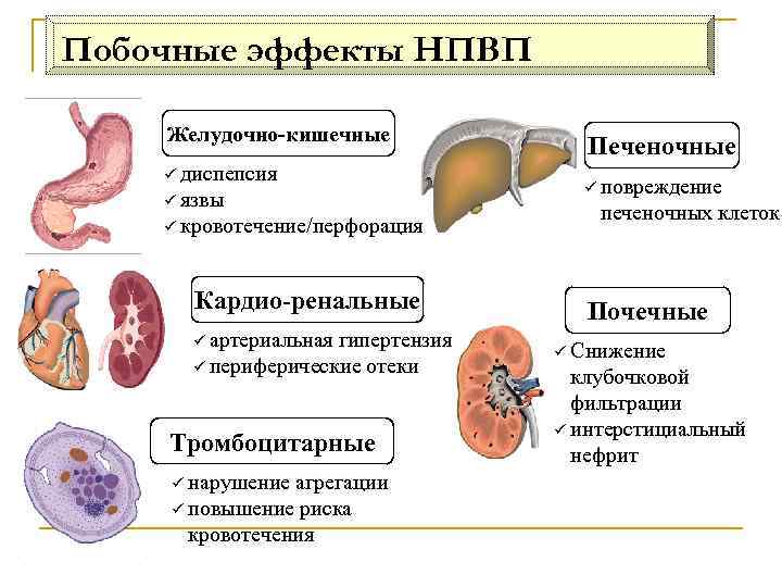 Побочные эффекты НПВП Желудочно-кишечные ü диспепсия ü язвы ü кровотечение/перфорация Кардио-ренальные ü артериальная гипертензия