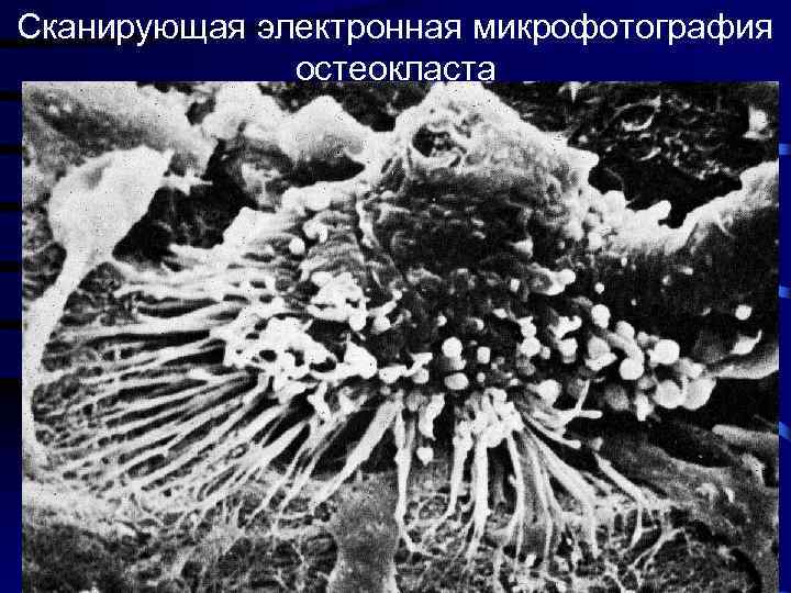 Сканирующая электронная микрофотография остеокласта 