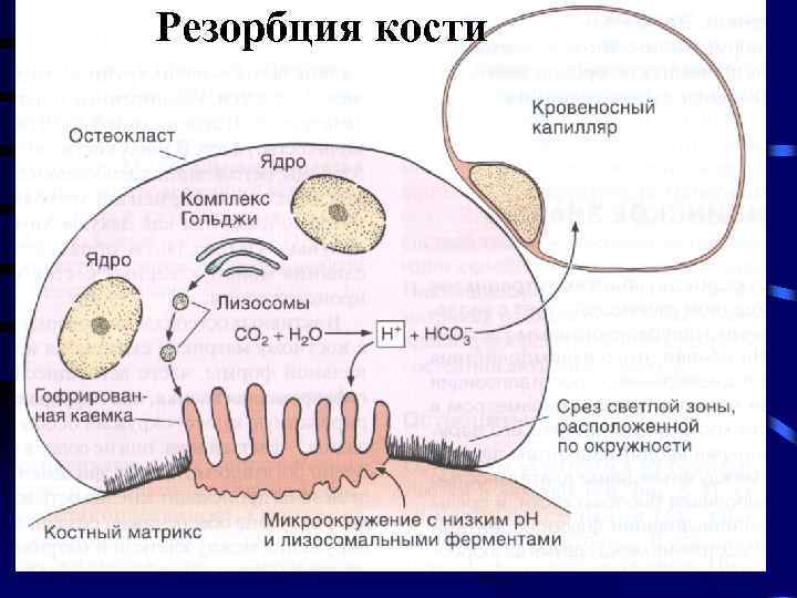 Резорбция кости 