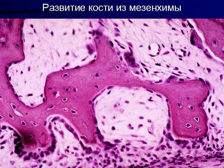 Развитие кости из мезенхимы 