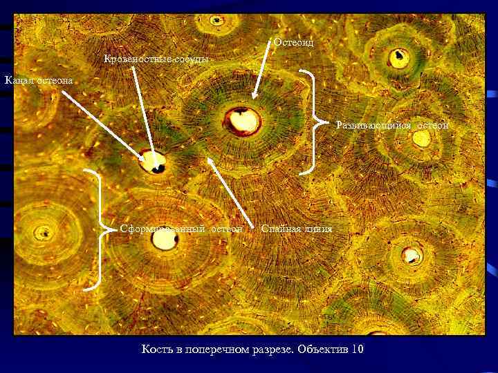 Остеоид Кровеностные сосуды Канал остеона Развивающийся остеон Сформированный остеон Спайная линия Кость в поперечном