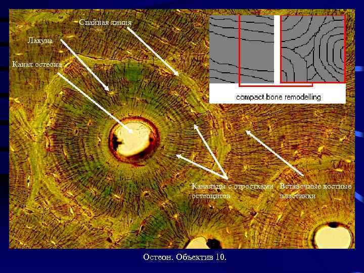 Спайная линия Лакуна Канал остеона Канальцы с отростками Вставочные костные остеоцитов пластинки Остеон. Объектив