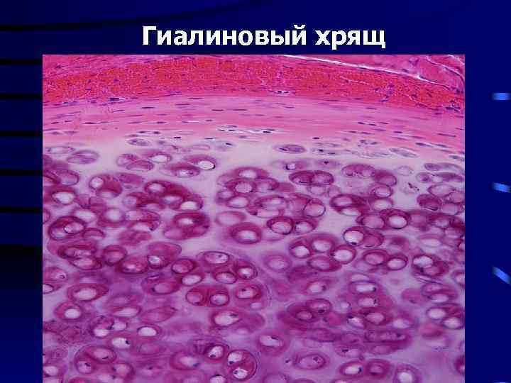Гиалиновый хрящ 