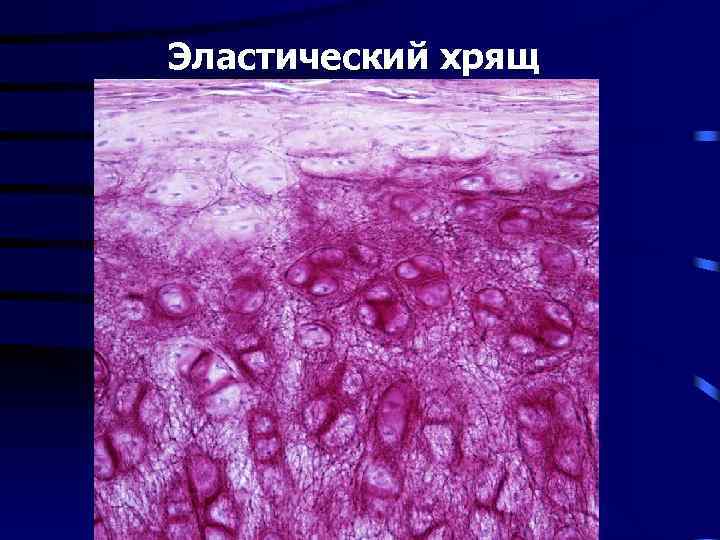 Эластический хрящ 