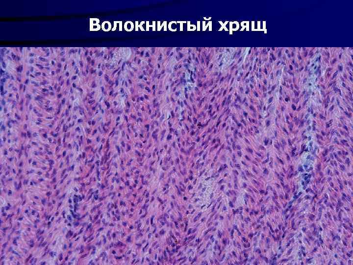 Волокнистый хрящ 