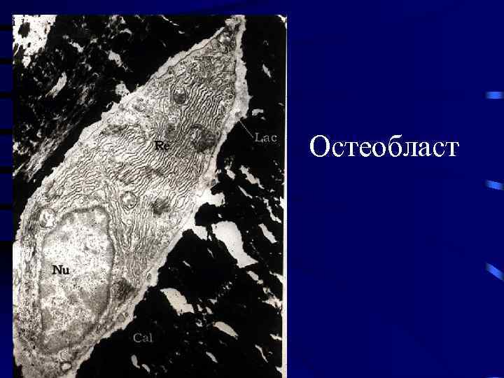Остеобласт 