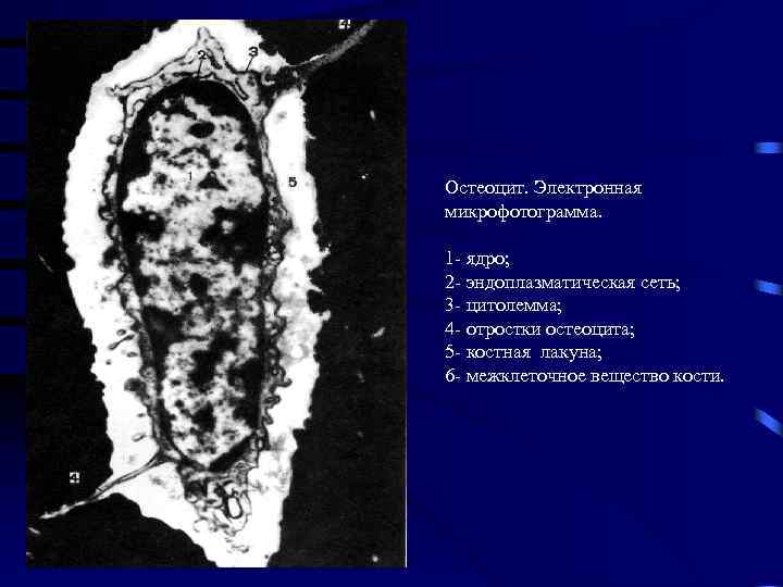 Остеоцит. Электронная микрофотограмма. 1 - ядро; 2 - эндоплазматическая сеть; 3 - цитолемма; 4