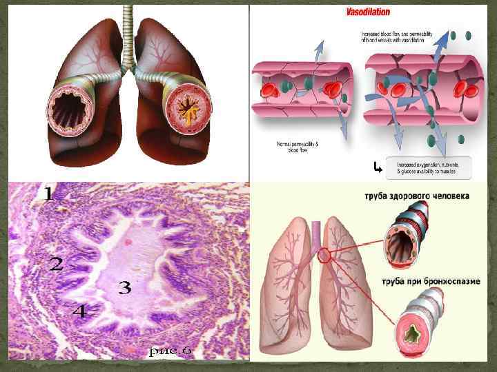 Иммунологические механизмы развития бронхиальной астмы