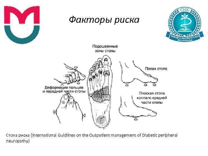 Факторы риска Стопа риска (International Guidlines on the Outpatient management of Diabetic peripheral neuropathy)