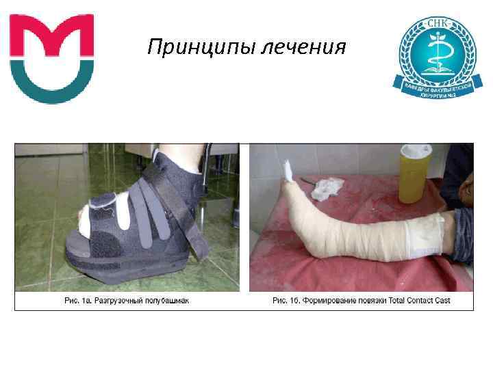 Принципы лечения 