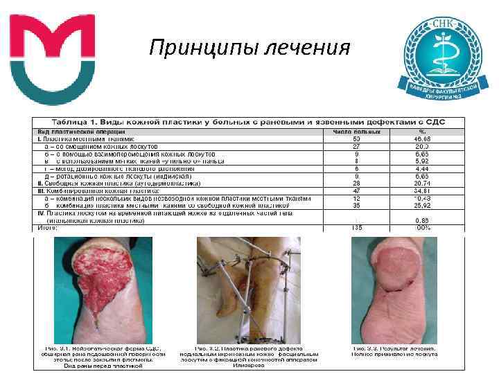 Принципы лечения 