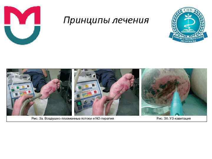 Принципы лечения 