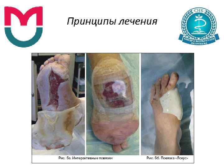 Принципы лечения 