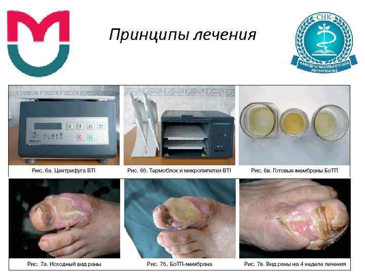 Принципы лечения 