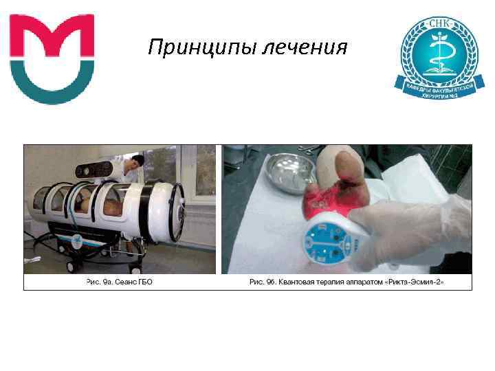 Принципы лечения 