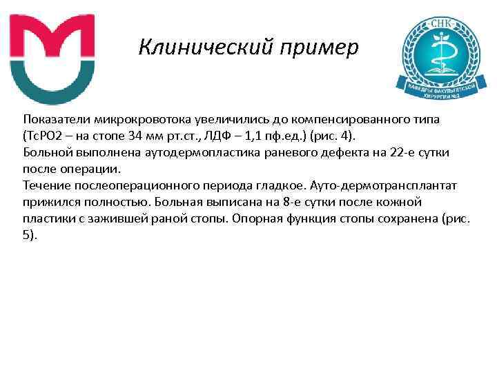 Клинический пример Показатели микрокровотока увеличились до компенсированного типа (Тс. РО 2 – на стопе