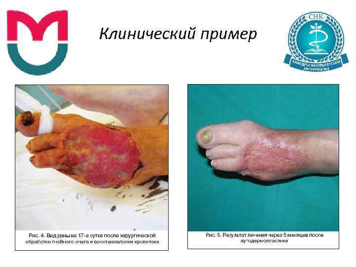 Клинический пример 