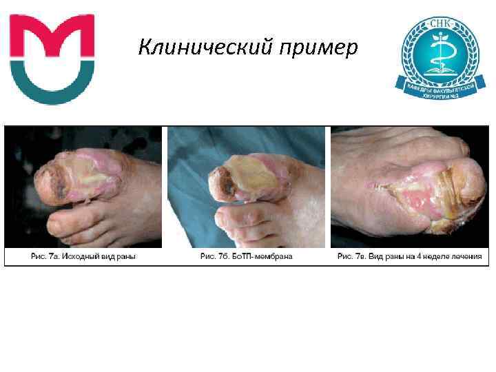 Клинический пример 