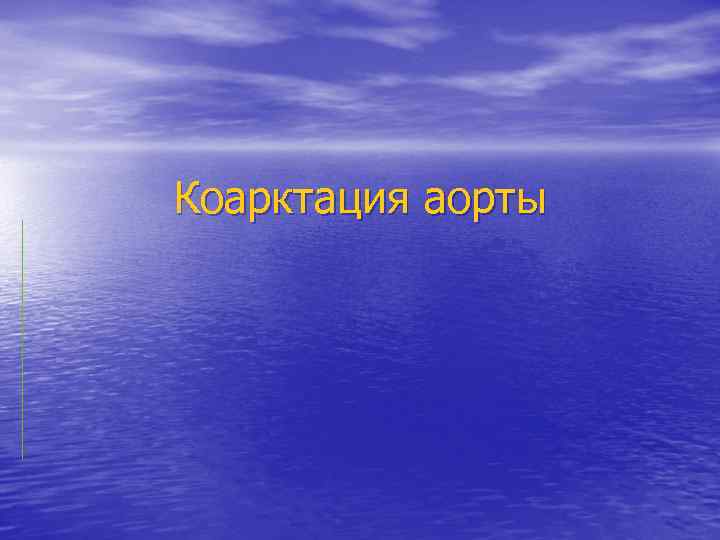 Коарктация аорты 