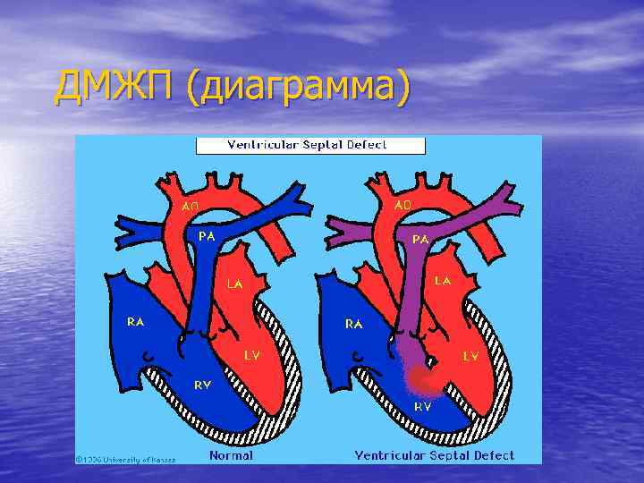 ДМЖП (диаграмма) 