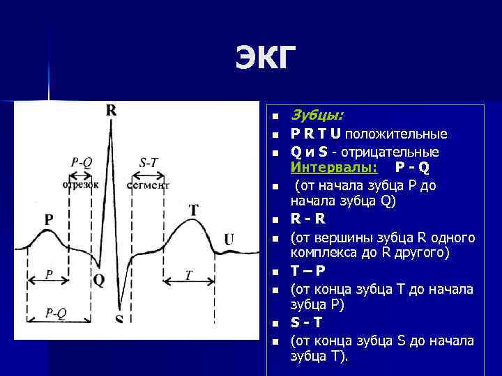 ЭКГ n n n n n Зубцы: Р R T U положительные Q и