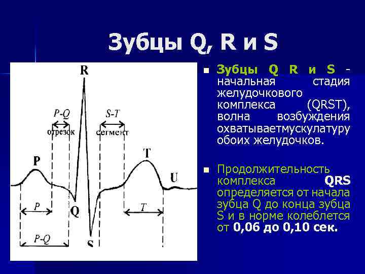 Зубцы Q, R и S n Зубцы Q R и S начальная стадия желудочкового