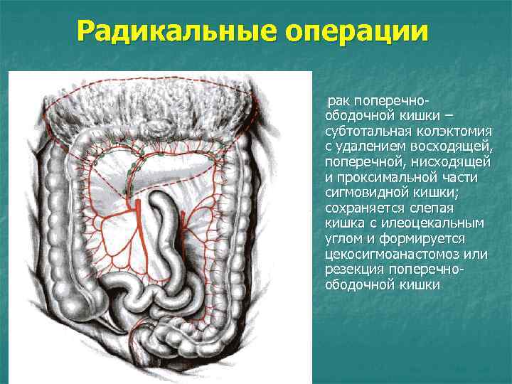 Строение стенки сигмовидной кишки