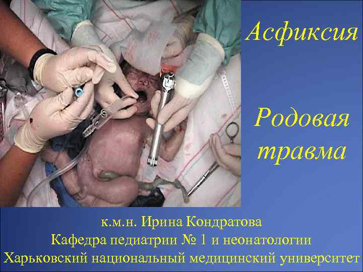 Асфиксия Родовая травма к. м. н. Ирина Кондратова Кафедра педиатрии № 1 и неонатологии