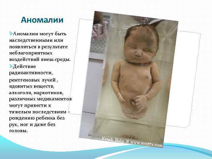 Аномалии ØАномалии могут быть наследственными или появляться в результате неблагоприятных воздействий внеш. среды. ØДействие