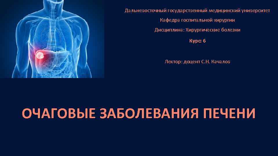 Дальневосточный государственный медицинский университет Кафедра госпитальной хирургии Дисциплина: Хирургические болезни Курс: 6 Лектор: доцент