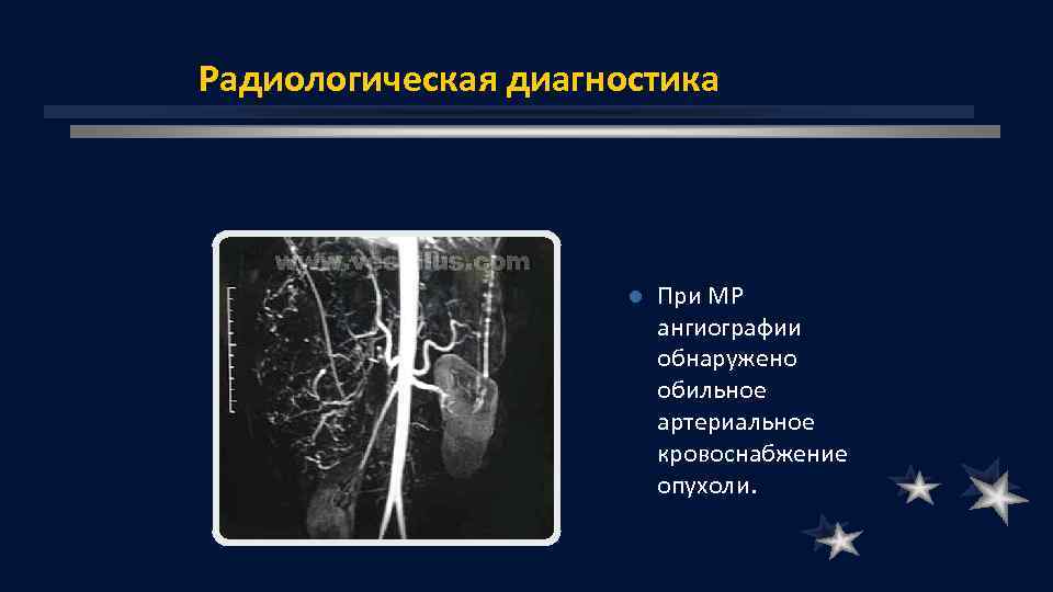 Радиологическая диагностика l При МР ангиографии обнаружено обильное артериальное кровоснабжение опухоли. 