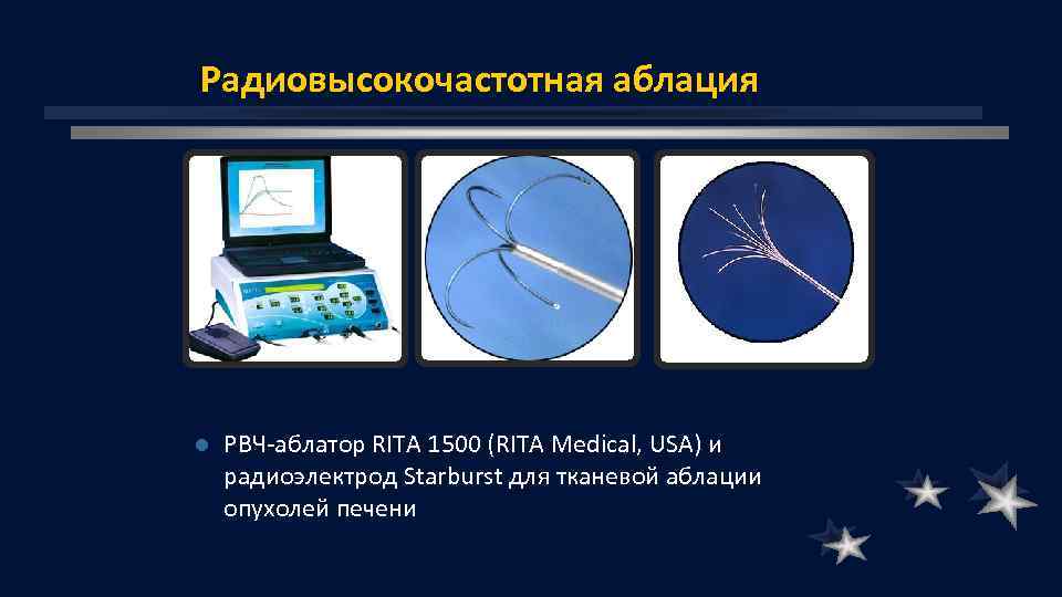 Радиовысокочастотная аблация l РВЧ аблатор RITA 1500 (RITA Medical, USA) и радиоэлектрод Starburst для